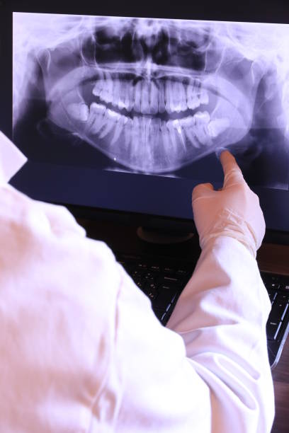Best Emergency Denture Repair in Madison, SD